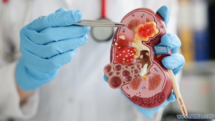 Close-up of urologist pointing pen kidney structure on anatomical model. Treatment of kidney diseases, pyelonephritis